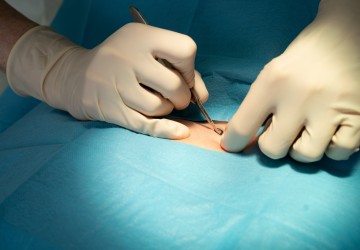 Vacature ANIO Dermatologie