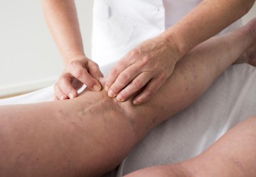 Wat kan de huidtherapeut betekenen voor patiënten met huidgerelateerde klachten ten gevolge van brandwonden?