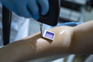 Lasertherapie